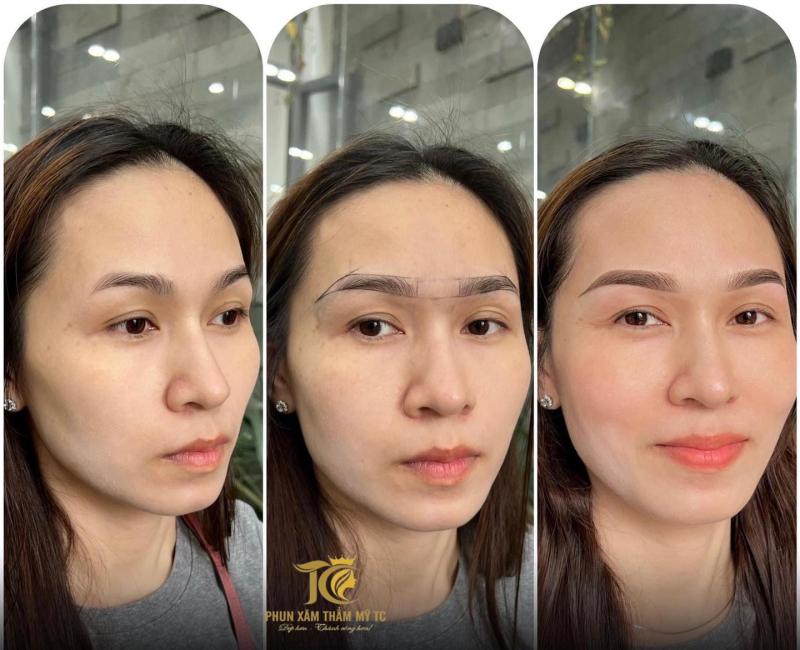 Thẩm Mỹ Viện Thành Công