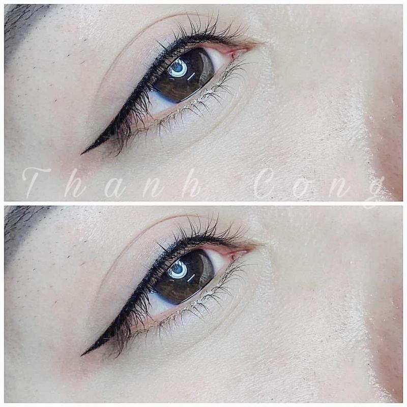 Thẩm Mỹ Viện Thành Công