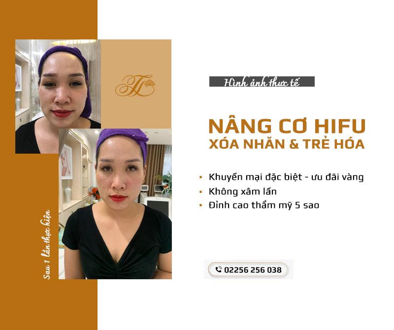 Thẩm mỹ viện Thanh Hòa