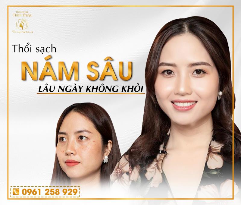 Thẩm Mỹ Viện Thiên Trang