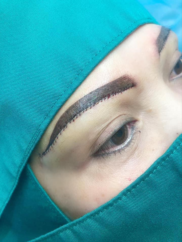 Thẩm Mỹ Viện Thuhuynh Beauty