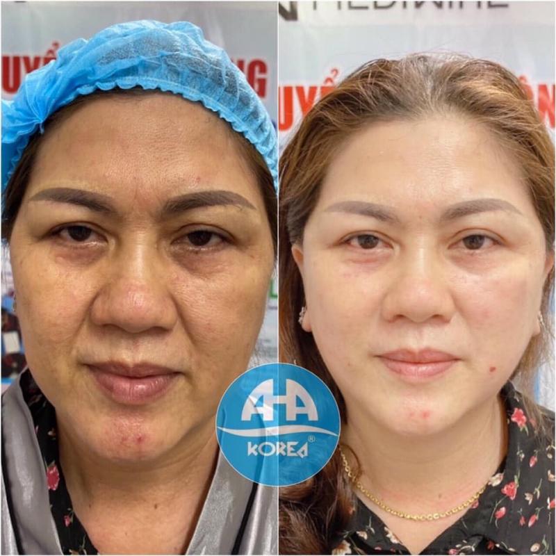 Thẩm Mỹ Viện Thuhuynh Beauty
