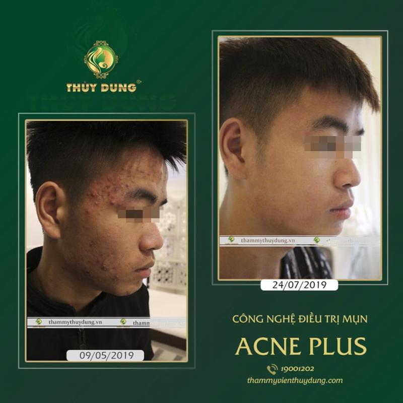 Thẩm Mỹ Viện Thùy Dung