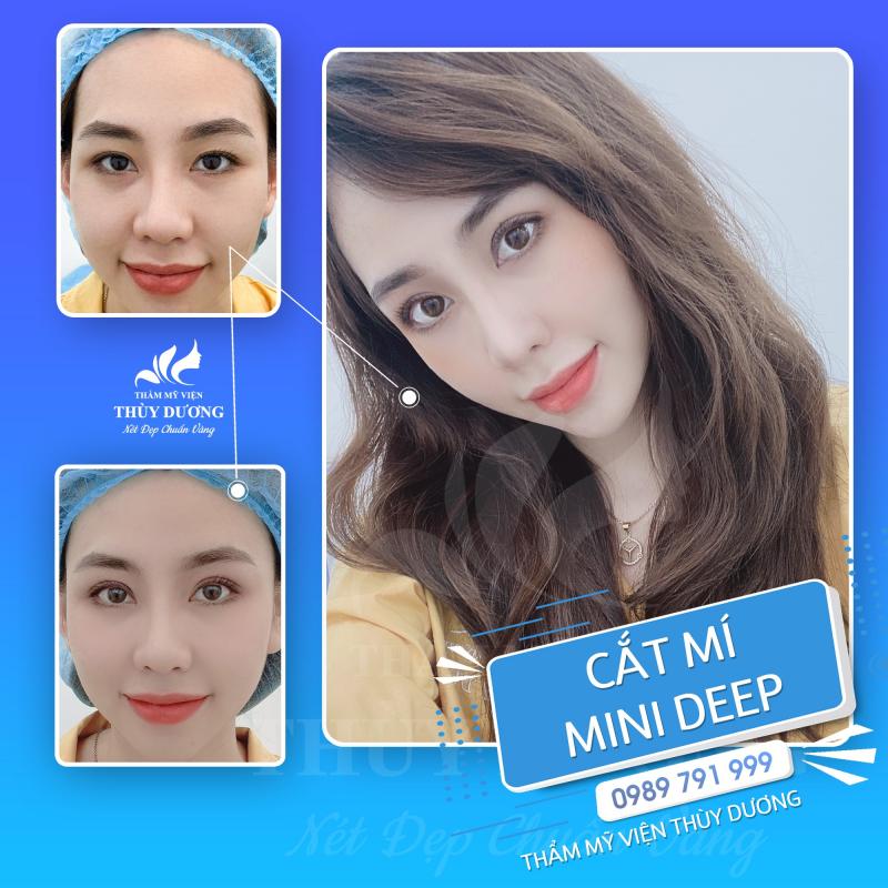 Thẩm mỹ viện Thùy Dương