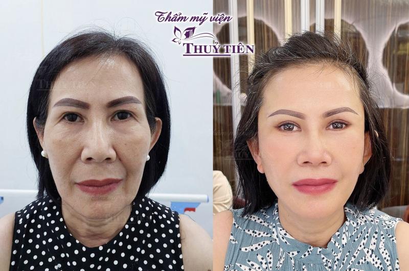 Thẩm Mỹ Viện Thủy Tiên