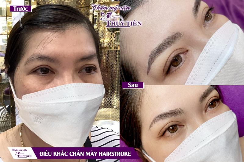 Thẩm Mỹ Viện Thủy Tiên