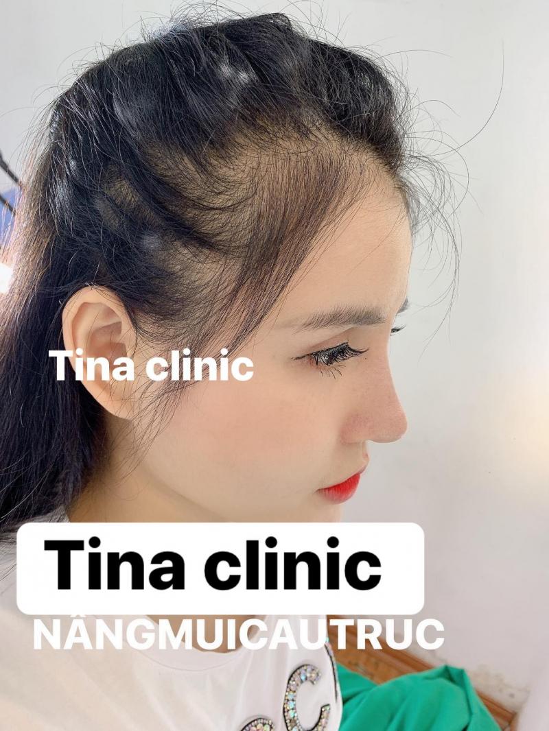Thẩm Mỹ Viện Tina Nguyễn