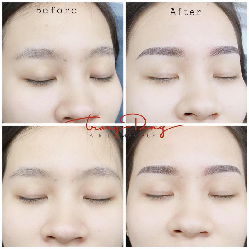 Thẩm mỹ viện Trang Dung