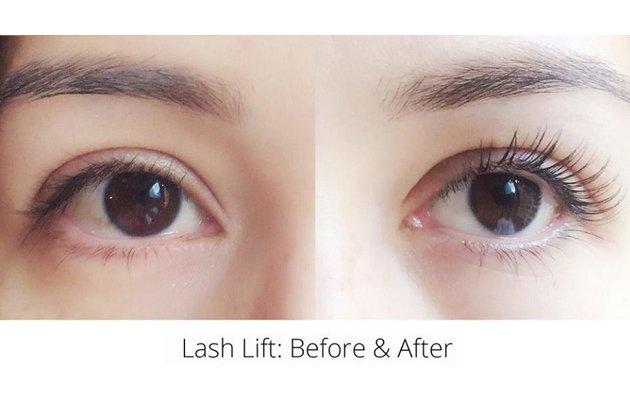 Thẩm Mỹ Viện Trương Kiều Xuân