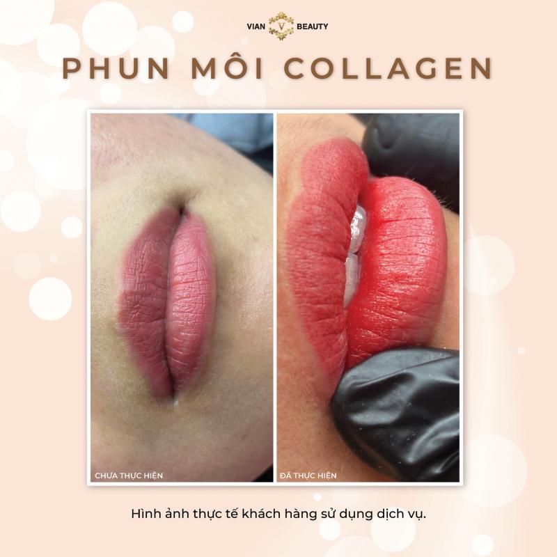 Thẩm Mỹ Viện Vian TP. Phan Rang