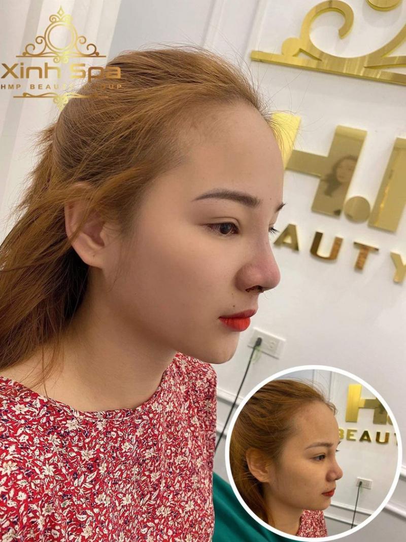 Thẩm Mỹ Viện Xinh Spa Center