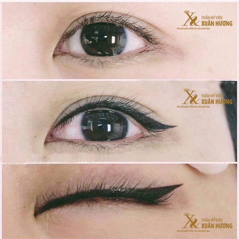 Thẩm mỹ viện Xuân Hương