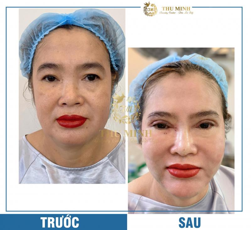 Thẩm Mỹ Viện Thu Minh