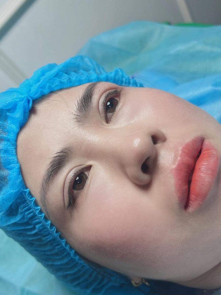 Thẩm mỹ Việt Hàn