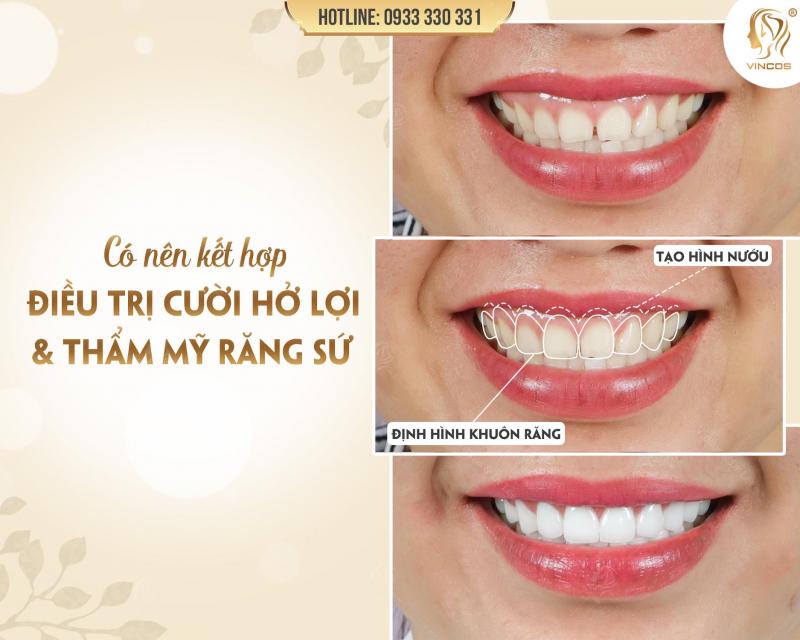 Thẩm mỹ VinCos & Dr Lee