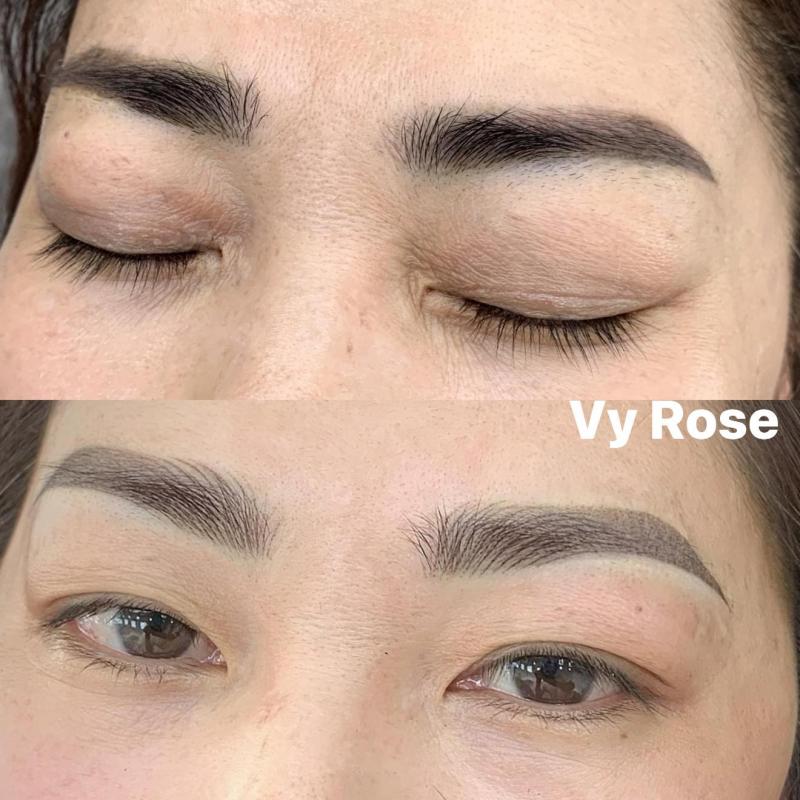 Thẩm Mỹ Vy Rose
