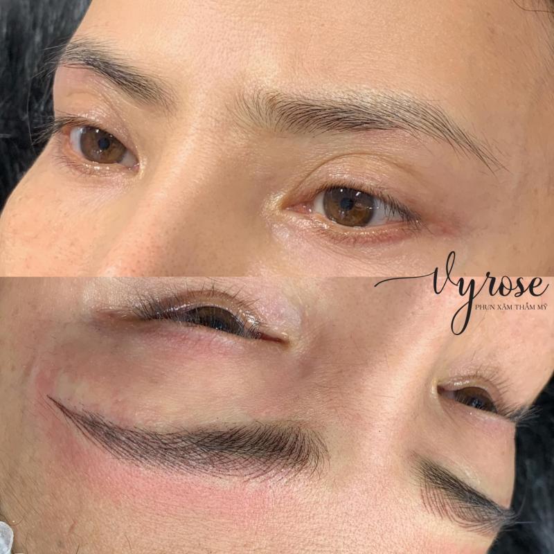 Thẩm Mỹ Vy Rose