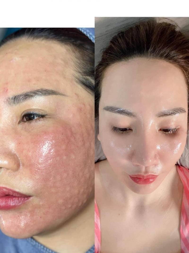 Thảo Lê Spa