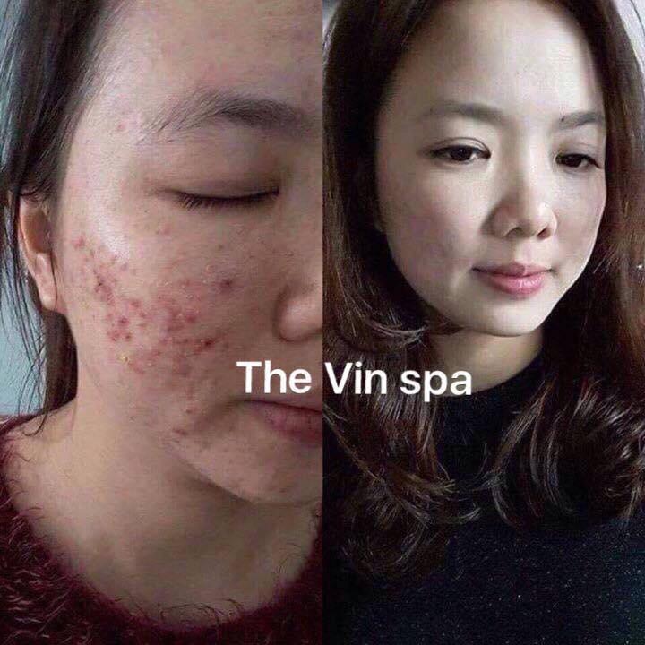 Spa Vin Đà Lạt
