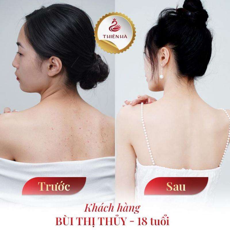 Thiên Hà Spa