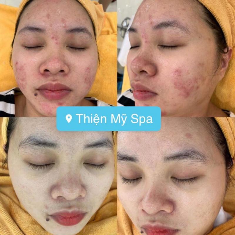 Thiện Mỹ Spa