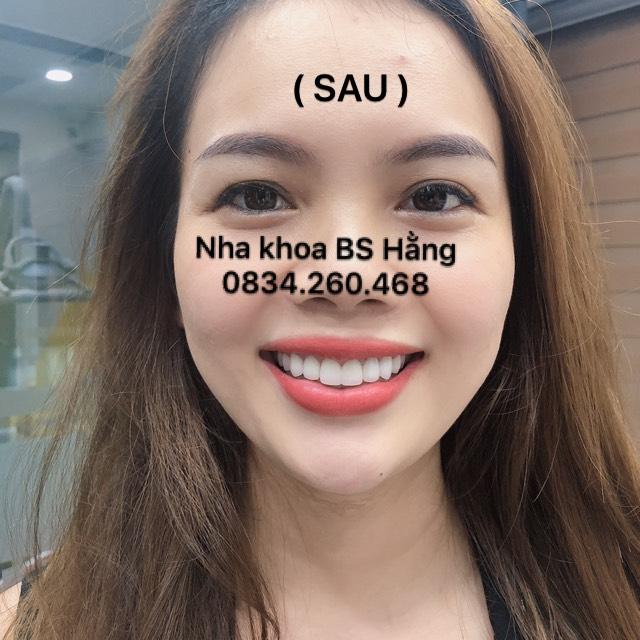 Thu Hằng Dental Clinic