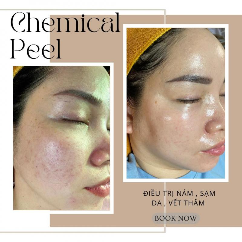 Thư Spa - Điều Trị Da