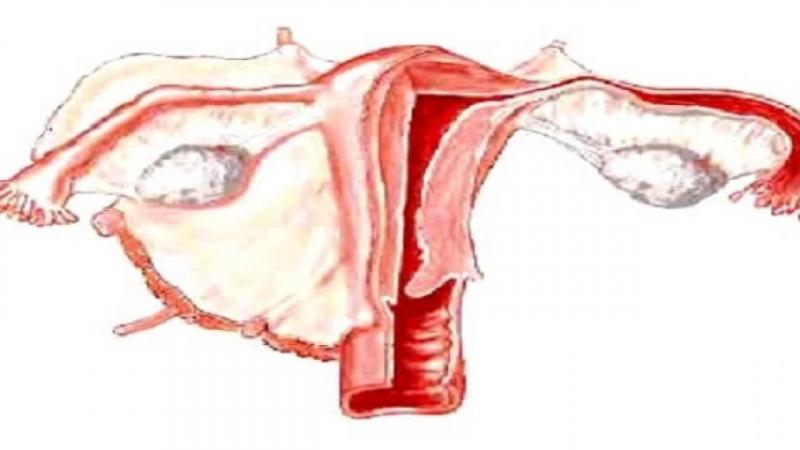 Thuốc ức chế PARP – điều trị duy trì trong ung thư buồng trứng
