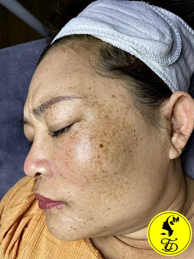 Tidi Spa Buôn Ma Thuột