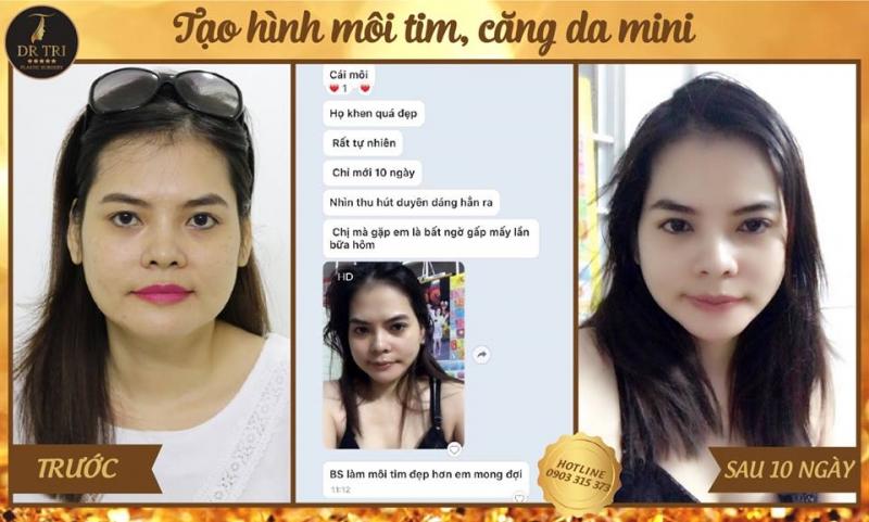 Tiến Sĩ Bác Sĩ Đỗ Thành Trí - Phẫu thuật Thẩm mỹ