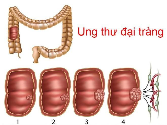 Tiền sử bệnh nhân