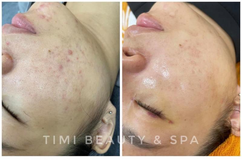 Timi Beauty & Spa