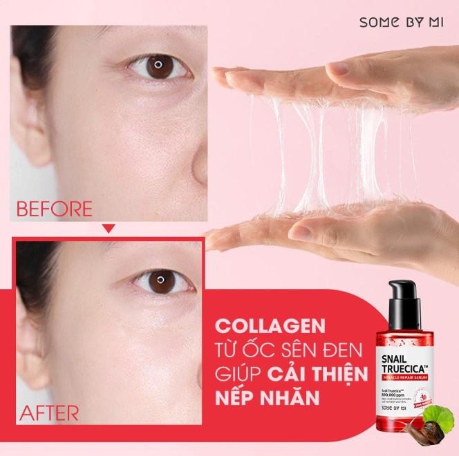 Tinh chất giảm sẹo lõm, sẹo mụn Some By Mi Snail Truecica Miracle Repair Serum