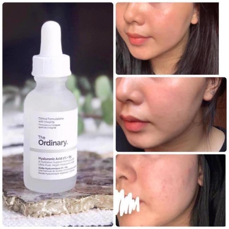Tinh chất The Ordinary Hyaluronic Acid 2% + B5