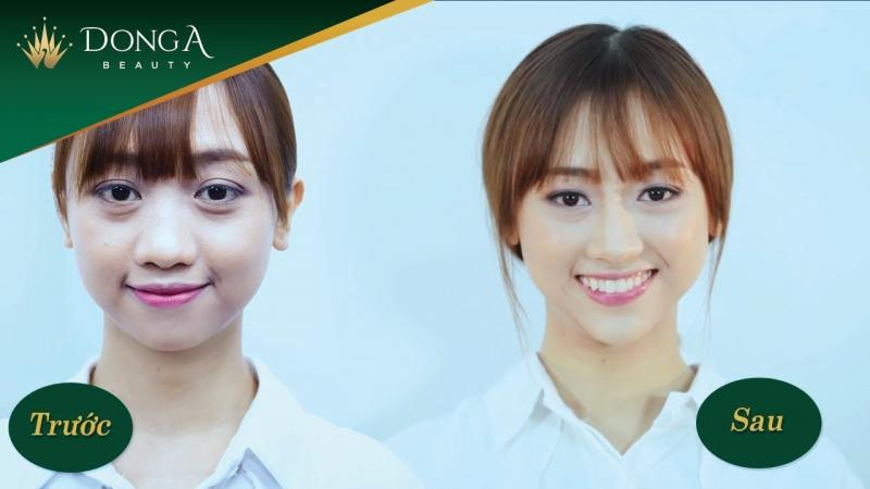 Thẩm mỹ viện Đông Á