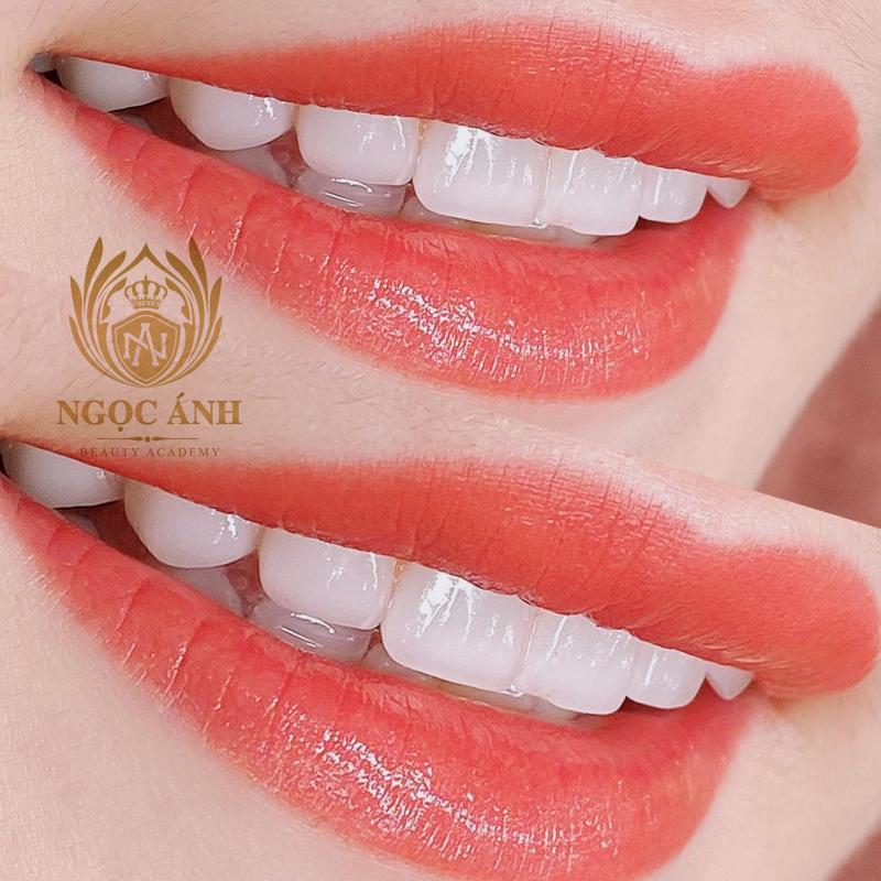 TMV Ngọc Ánh