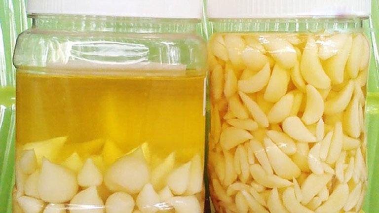 Rượu tỏi chữa đau nhức răng