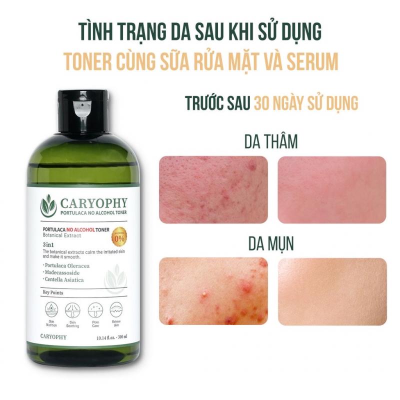 Toner không cồn Caryophy Portulaca