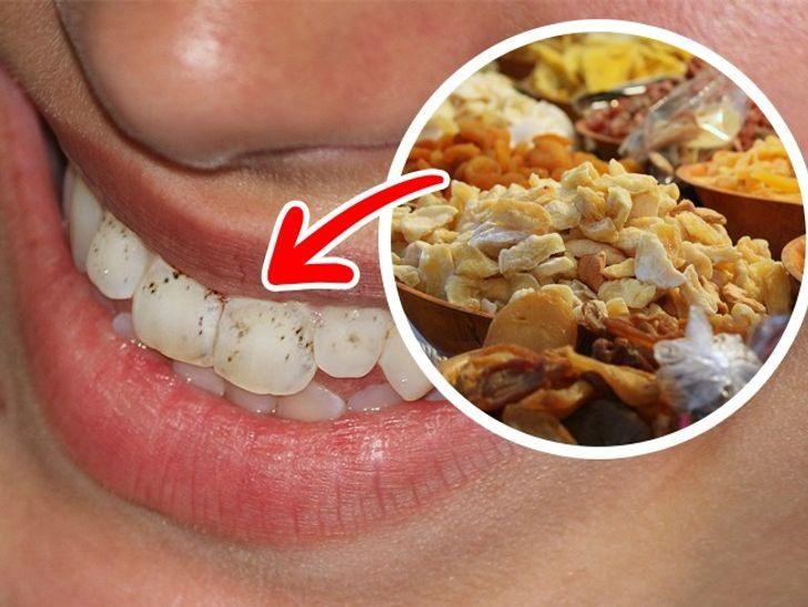 Trái cây sấy khô gây sâu răng
