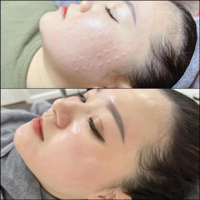 Trang Ly Spa Clinic