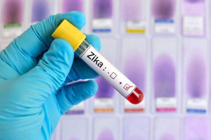 Xét nghiệm bệnh virut Zika