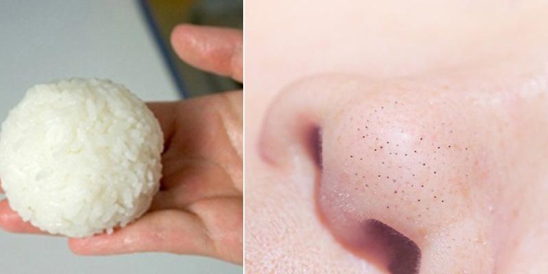 Trị mụn đầu đen bằng cơm nóng, có thể dễ dàng lấy đi cồi nhân mụn và lớp bã nhờn trên bề mặt da