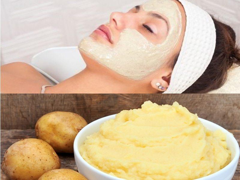 Trị mụn đầu đen bằng khoai tây