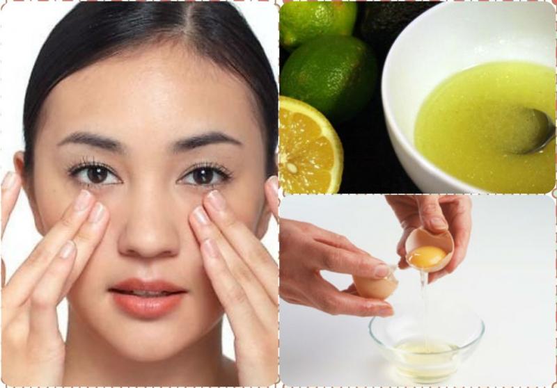 Lòng đỏ trứng gà kết hợp với chanh giúp lột nhẹ mụn đầu đen