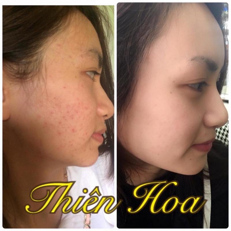 Khách hàng sử dụng sản phẩm