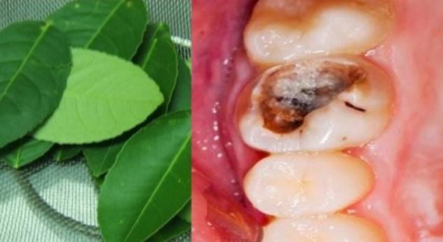 Lá chanh trị nhức răng