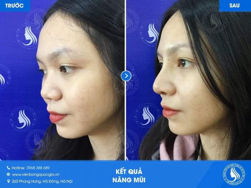 Trung tâm tạo hình thẩm mỹ - Viện bỏng Quốc gia