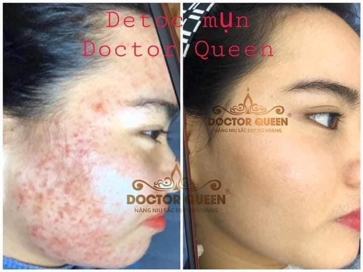 Trung Tâm Thẩm Mỹ Ánh Nguyễn