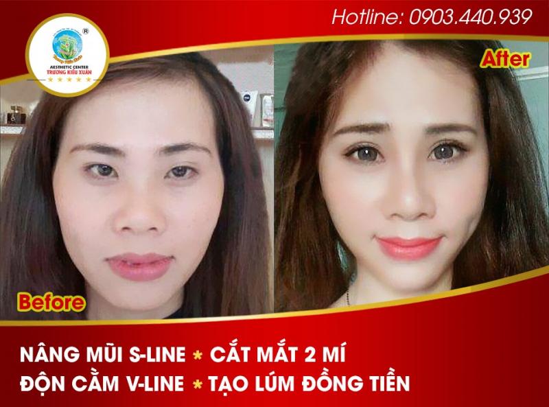 TMV Trương Kiều Xuân