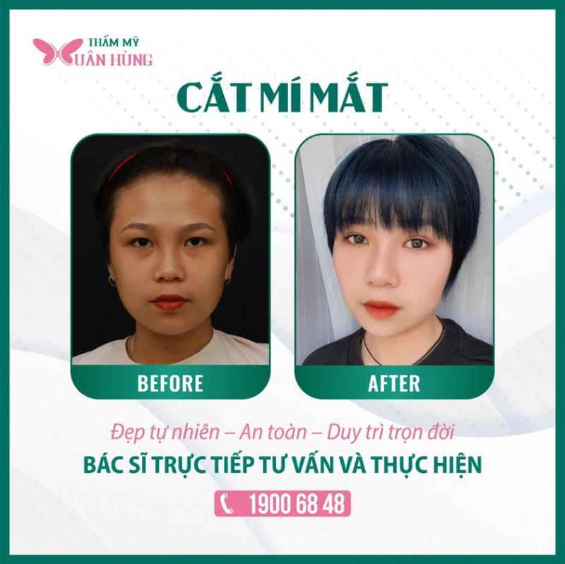 Trung tâm thẩm mỹ Xuân Hùng